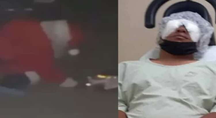 El hombre llamado Miguel que se viste de Santa Claus, pierde el ojo tras la explosión de un cohete